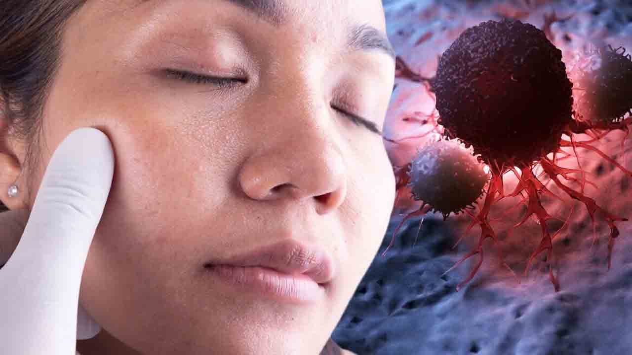 Stomach Cancer | ముఖంపై ‘ఉదర క్యాన్సర్‌’ లక్షణాలు!