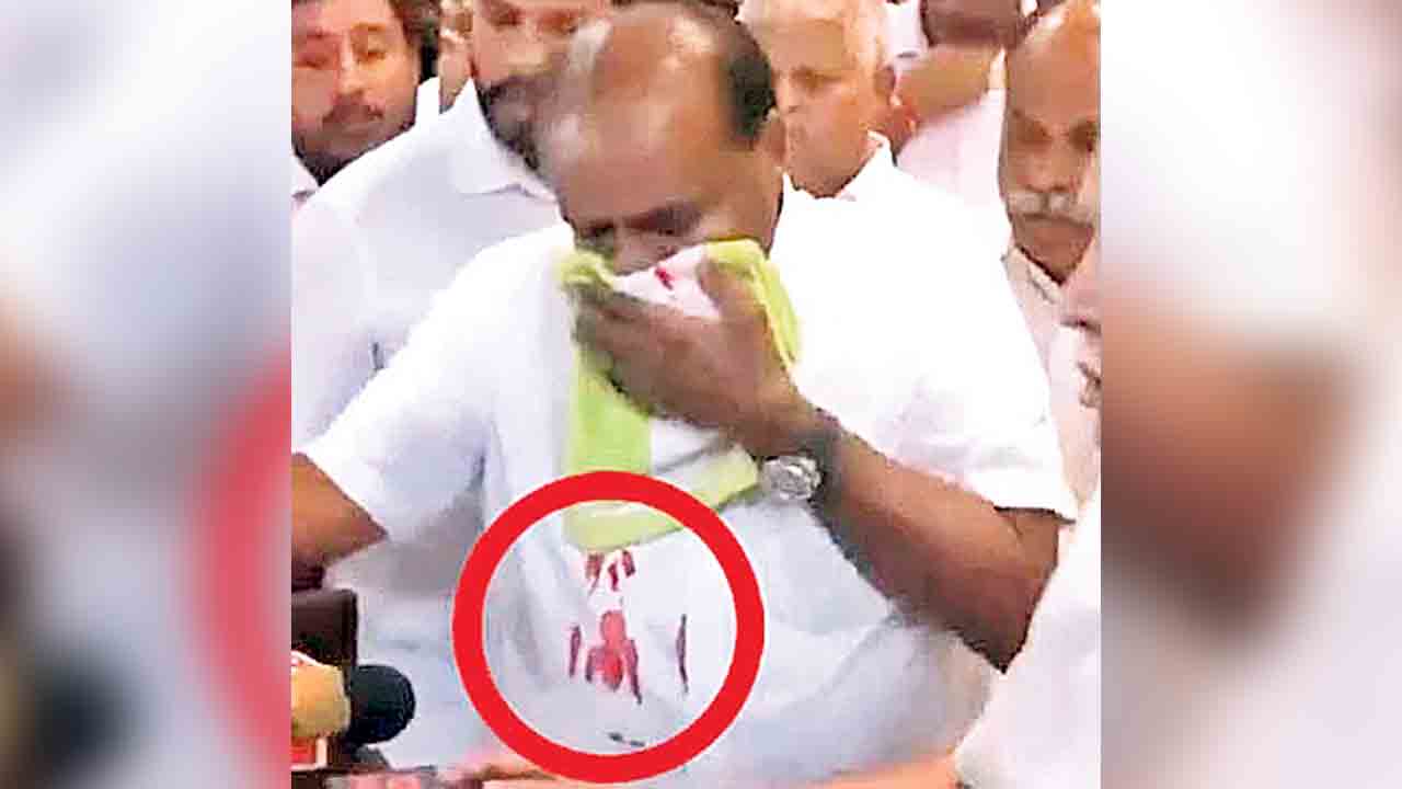 కుమారస్వామికి అస్వస్థత