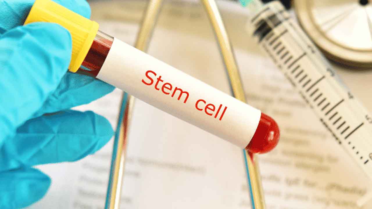 AIDS | స్టెమ్‌ సెల్‌ చికిత్సతో ఎయిడ్స్‌ పూర్తిగా నయం