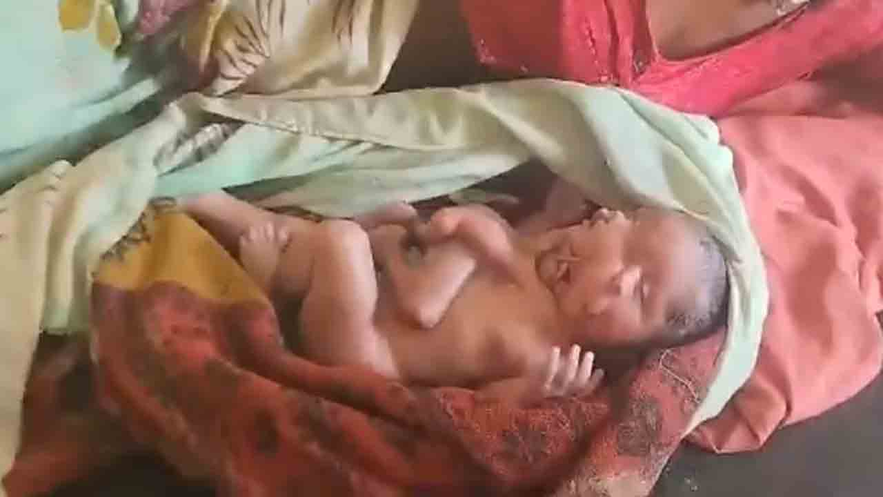Baby With 2 Faces, 4 Legs, 4 Arms | రెండు ముఖాలు, నాలుగు చేతులు, నాలుగు కాళ్లతో పుట్టిన   శిశువు.. వీడియో వైరల్‌