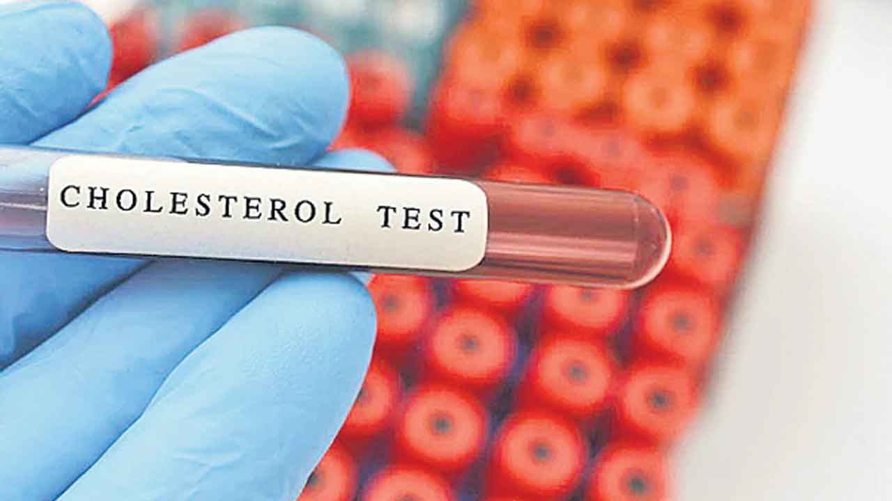 Cholesterol | సైలెంట్‌ కిల్లర్‌ అధిక కొలెస్ట్రాల్‌.. కంట్రోల్‌ చేసుకోకపోతే ముప్పు తప్పదు