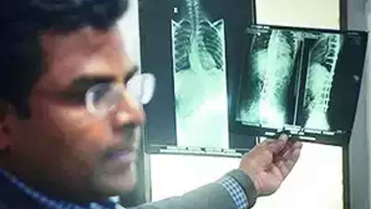 వైద్యుల నిర్లక్ష్యం.. 20 ఏండ్ల తర్వాత పరిహారం