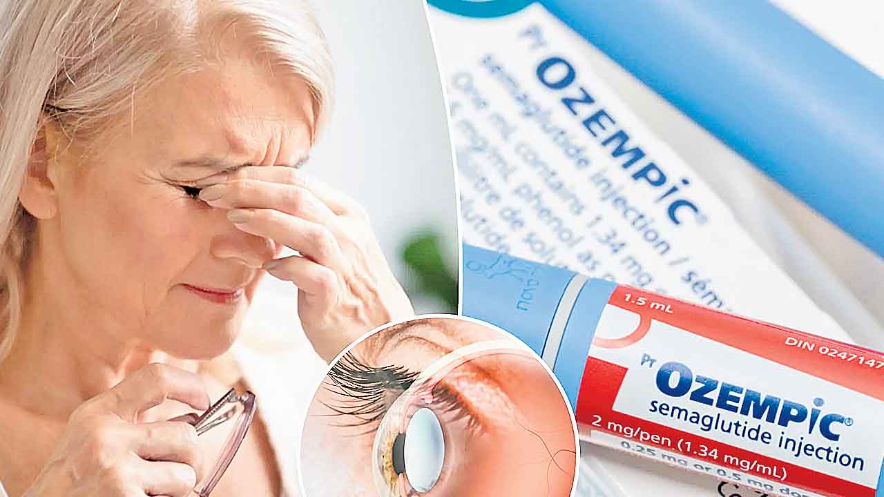 Weight Loss | వెయిట్‌ లాస్‌ మందులతో కంటిచూపు పోయే ప్రమాదం!