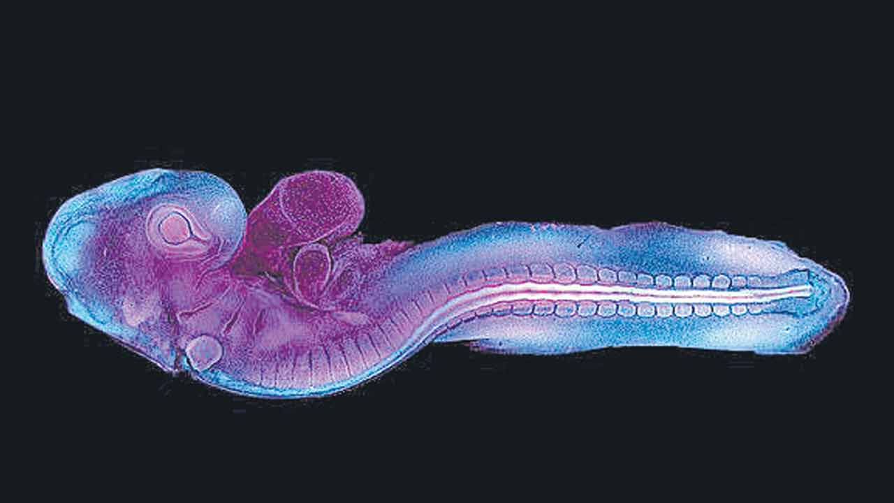 Fetus | పిండం గుట్టు రట్టు.. పుట్టుకతో వచ్చే లోపాలపై ఆస్ట్రేలియా పరిశోధకుల అధ్యయనం