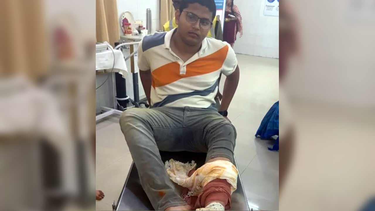 Tirumala | తిరుమలలో కలకలం.. నడకమార్గంలో వెళ్తున్న భక్తుడిని కాటేసిన పాము