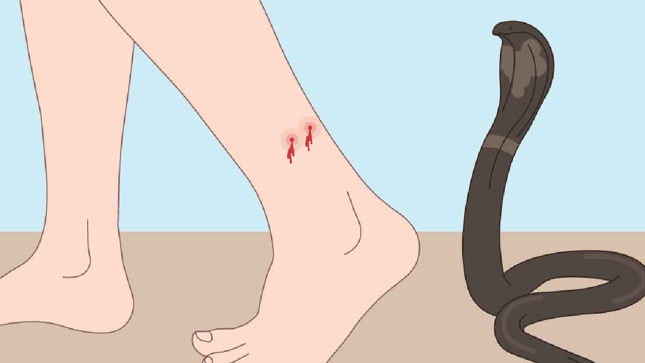 5 సార్లు పాముకాటు.. అయినా బతికాడు!