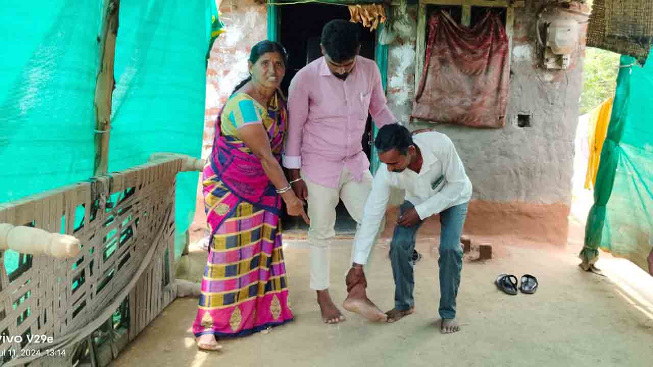 Harish Rao | కాంగ్రెస్ ఎమ్మెల్యేను ప్ర‌శ్నించినందుకు గిరిజ‌నుడిని హింసించ‌డం బాధాక‌రం : హ‌రీశ్‌రావు