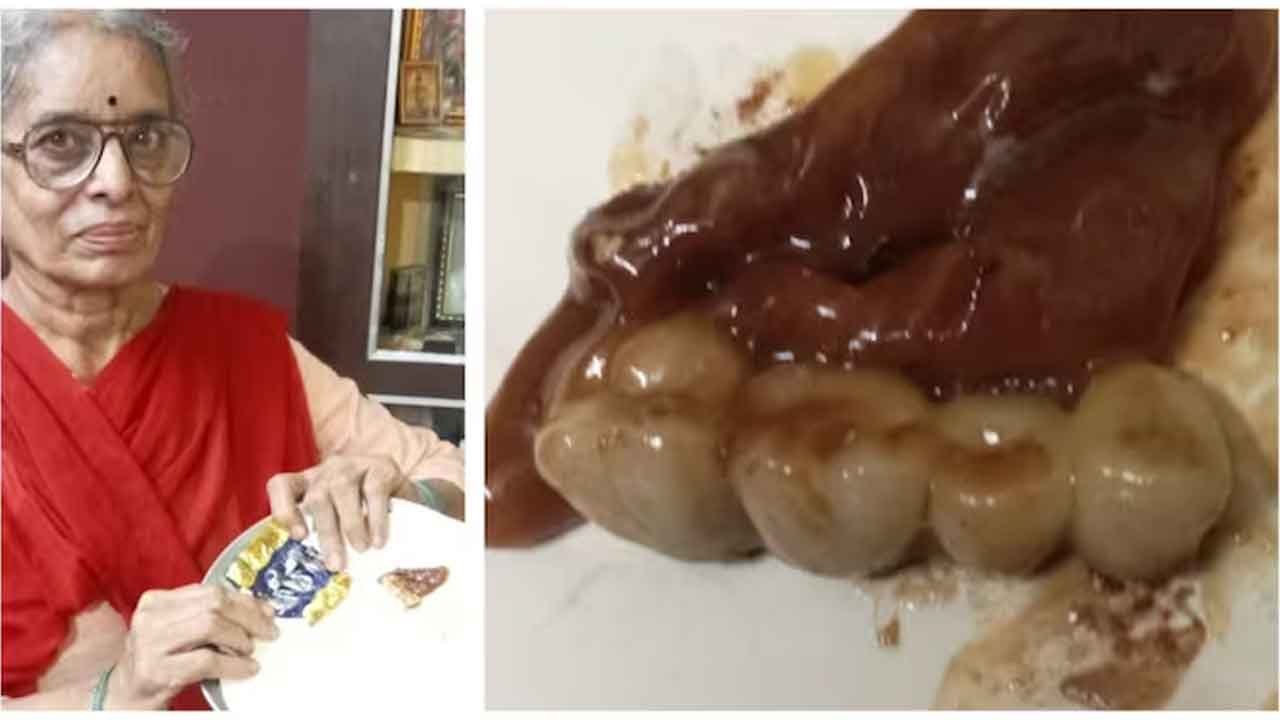 చాకొలెట్‌లో 4 కృత్రిమ దంతాలు