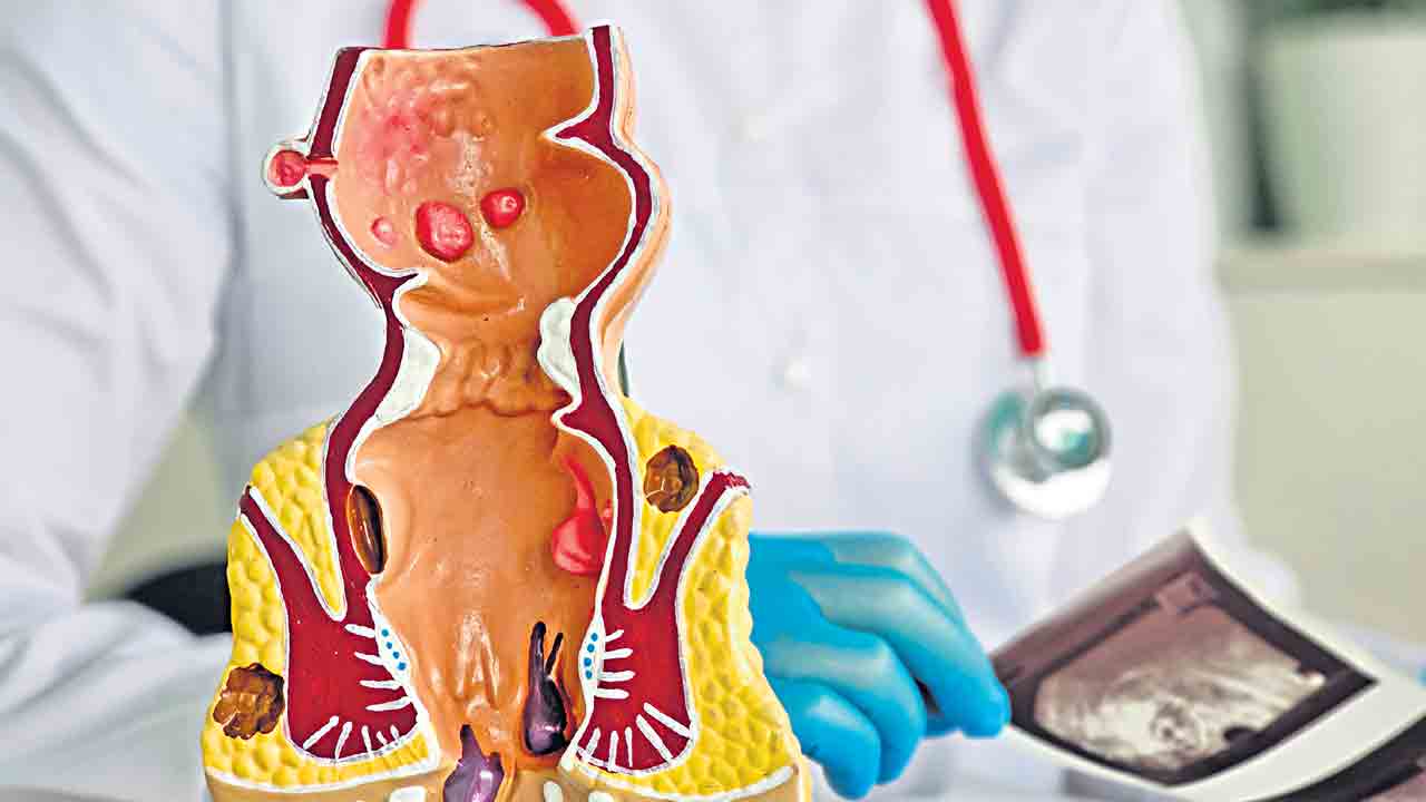 గోటితో పోయేవే