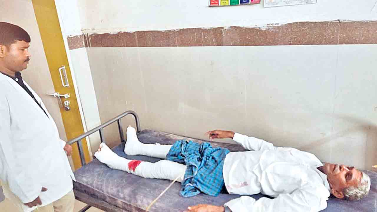 Crime news | ఆస్తి కోసం తండ్రి కాళ్లు విరగగొట్టిన కూతురు.. భర్తతో కలిసి ఘాతుకం..!