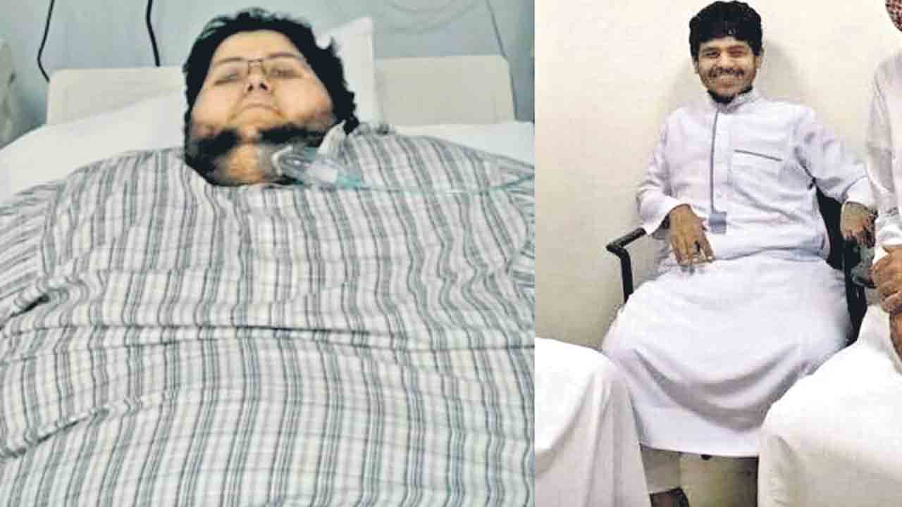 Weight Loss | ఆరునెలల్లో 540 కిలోలు తగ్గిన యువకుడు..! ఇంతకీ ఏం చేశాడో తెలుసా..?