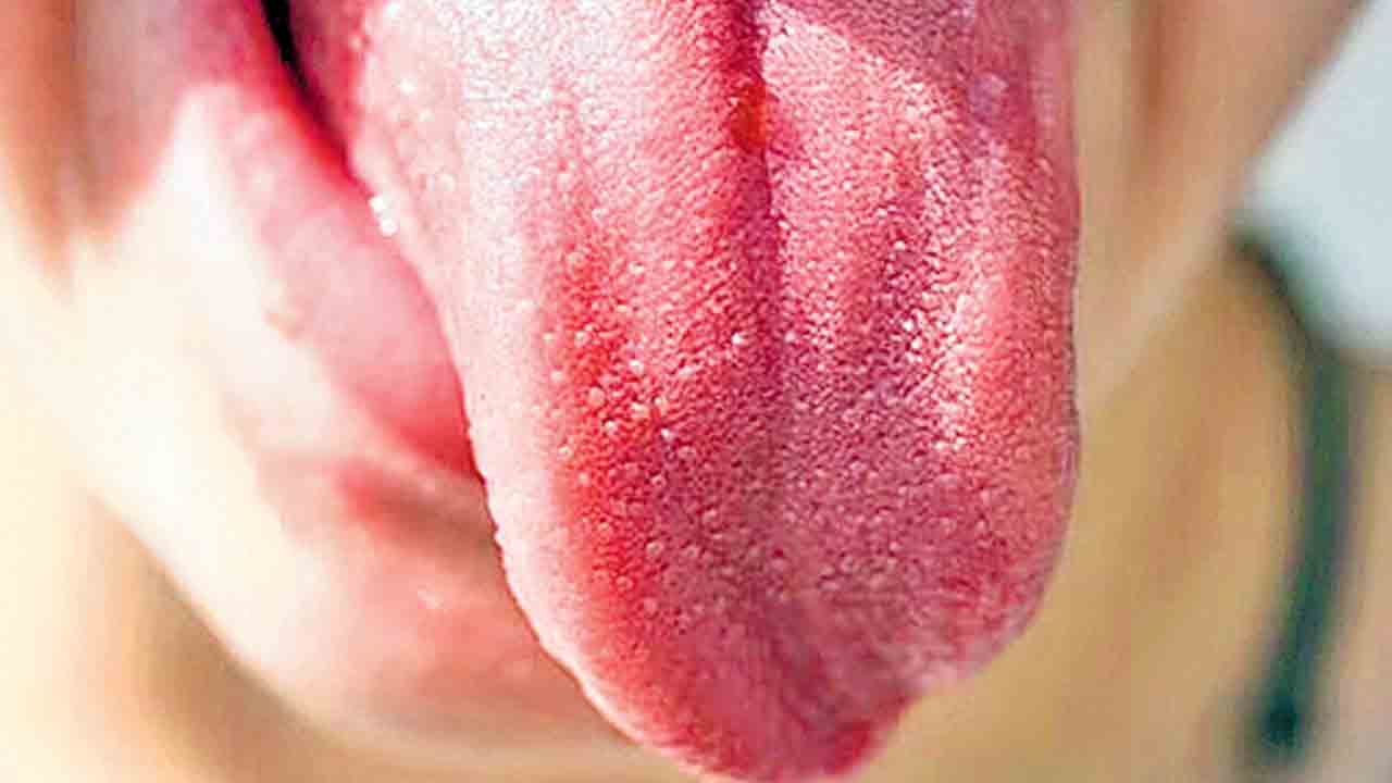 Artificial Intelligence | నాలుక రంగును చూసి వ్యాధులలను గుర్తించే కృత్రిమ మేధ