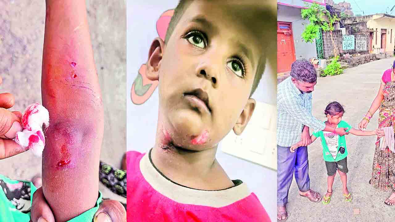 వీధి కుక్కల వీరంగం