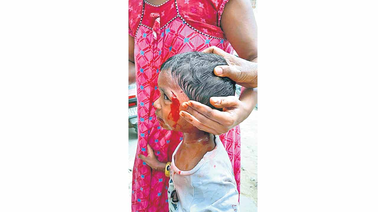 Street Dogs | దొరికినవారిని దొరికినట్లు.. బాలానగర్లో పిచ్చికుక్క స్వైర విహారం