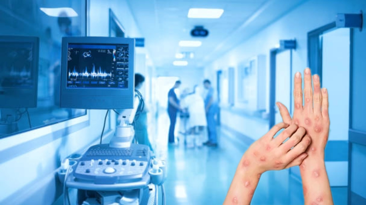 Monkeypox | మంకీపాక్స్‌పై కేంద్ర ఆరోగ్యశాఖ అప్రమత్తం.. సఫ్దర్‌జంగ్‌ ఆసుపత్రిలో ఐసోలేషన్‌ వార్డు ఏర్పాటు