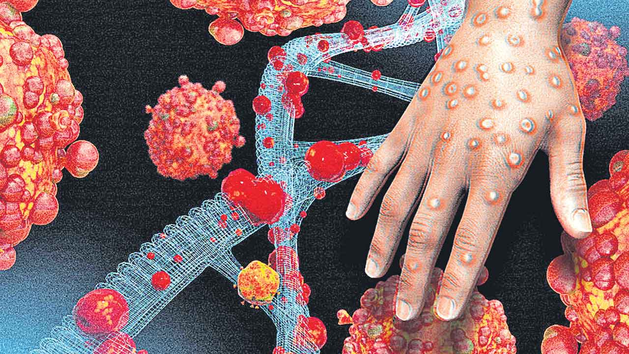 Monkeypox | ఆఫ్రికన్‌ దేశాలను వణికిస్తున్న మంకీపాక్స్‌.. 15 వేల మందికి సోకిన వ్యాధి