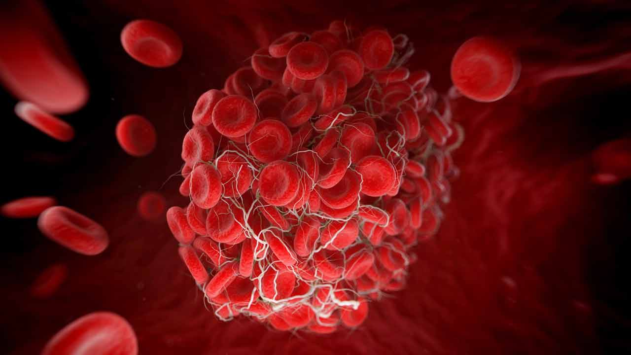 హిమోగ్లోబిన్‌ ఎక్కువైనా కష్టమే