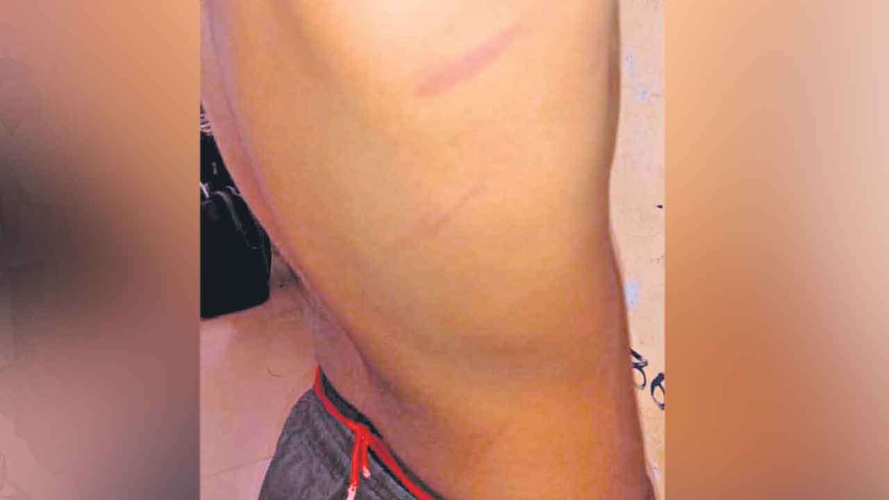 విద్యార్థిని చితకబాదిన కళాశాల సిబ్బంది