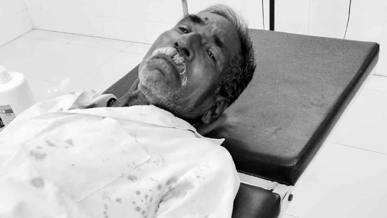 Dog attacks | ఇంటి ముందు కూర్చున్న వృద్ధుడిపై వీధి కుక్క దాడి.. తీవ్ర గాయాలు