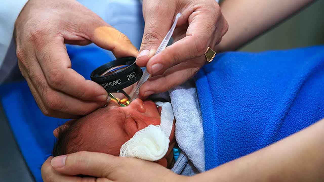 Parenting | ప్రీమెచ్యూర్‌ బిడ్డకు.. కంటి పరీక్షలు ఎందుకు?