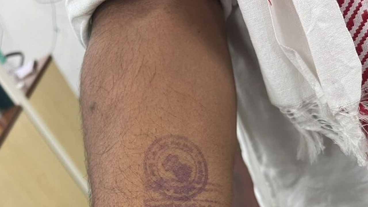 Hemant Soren: హేమంత్ సోరెన్ చేయిపై ఖైదీ ముద్ర‌.. ఫోటో షేర్ చేసిన జార్ఖండ్ సీఎం