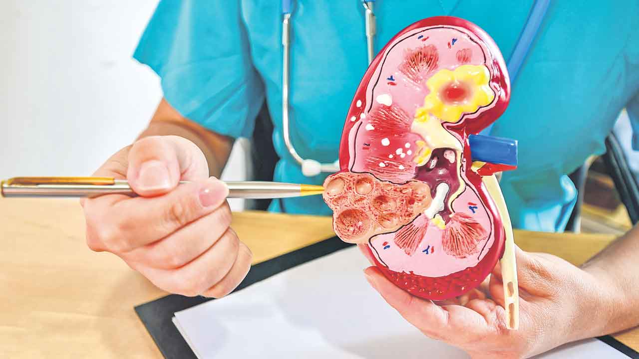 మార్పిడే మంచి రక్ష