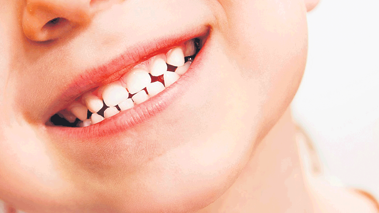 Health Tips | చిన్నారుల నవ్వులు చిరకాలం ఉండాలంటే?