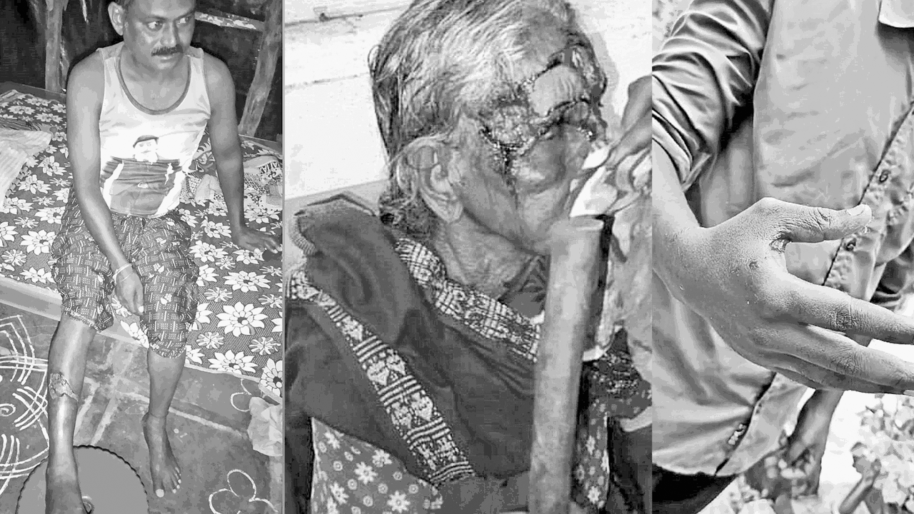 పిచ్చికుకల స్వైర విహారం