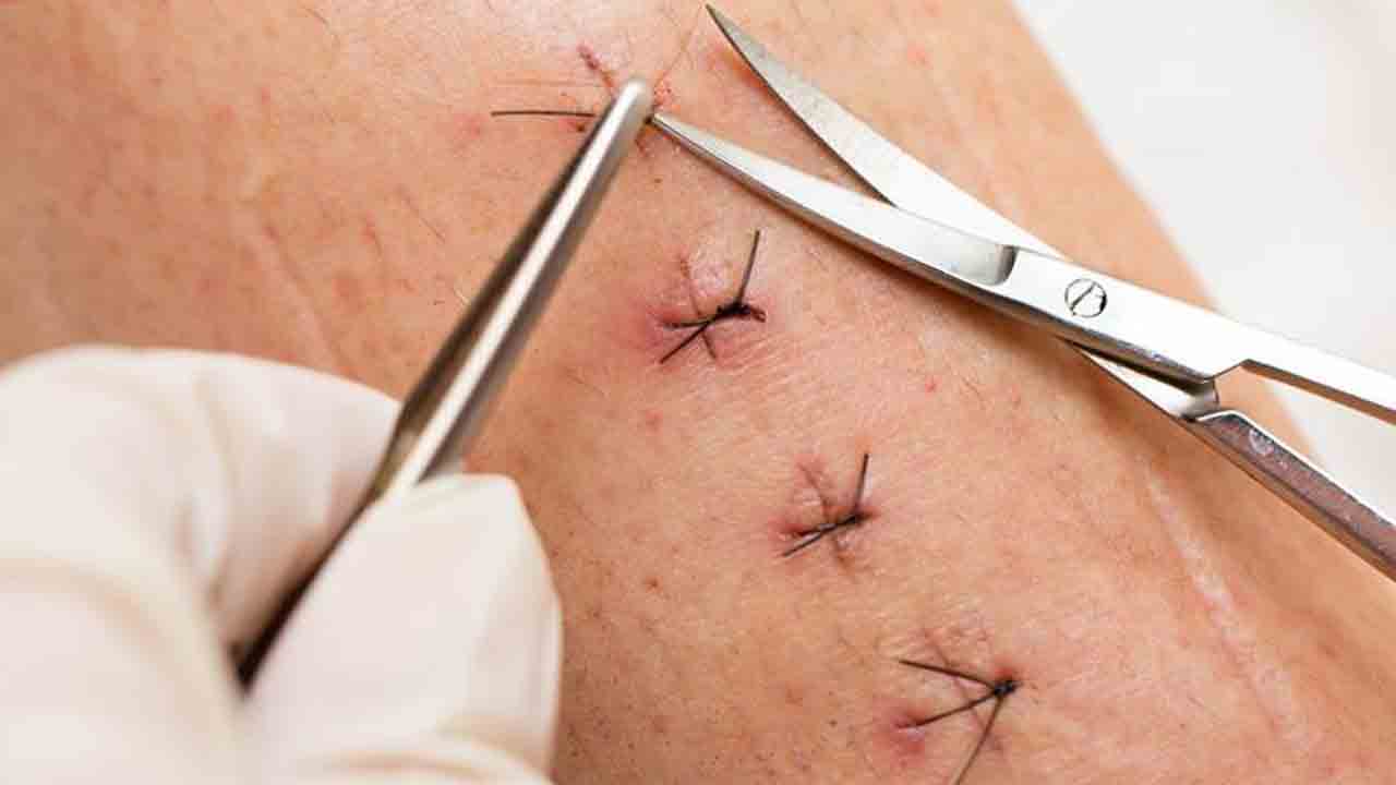 Kamareddy | ప్రైవేట్‌ దవాఖాన పైశాచికం.. ఫీజు ఇవ్వలేదని కుట్లు తొలగింపు