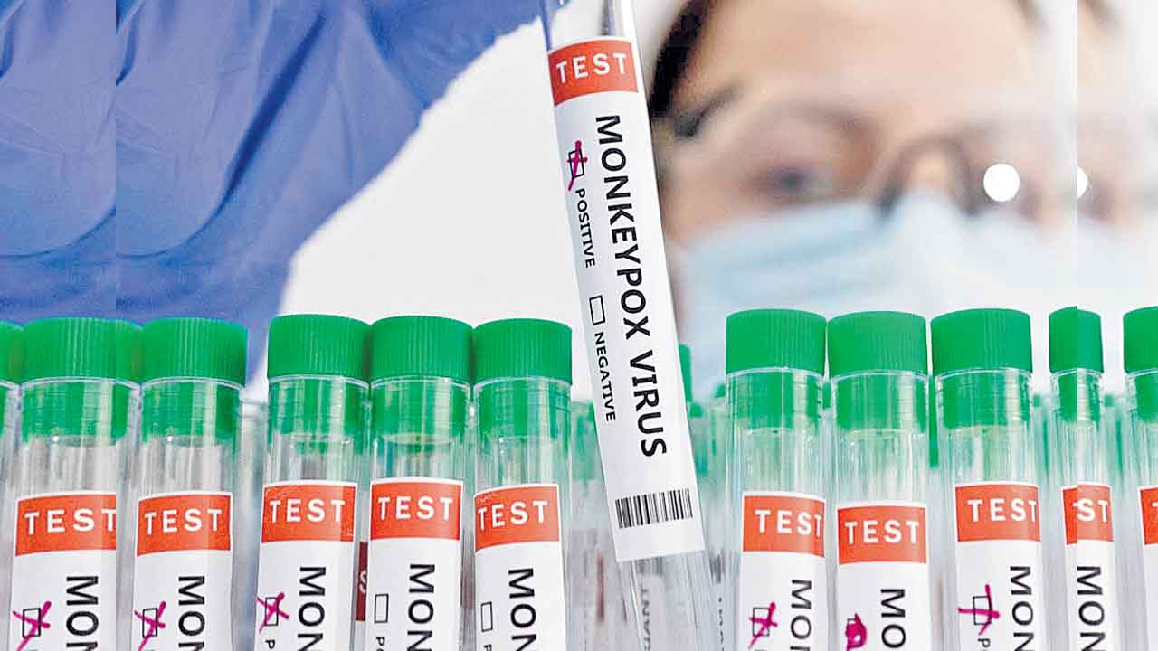 Monkeypox | దేశంలో మంకీపాక్స్‌ నిర్ధారణ.. రాష్ర్టాలను అప్రమత్తం చేసిన కేంద్ర ప్రభుత్వం