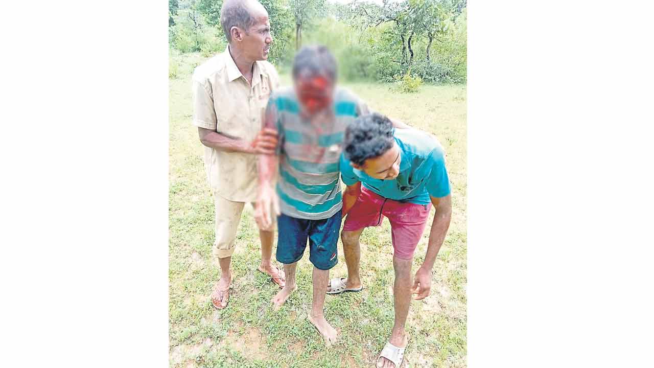 ఎలుగుబంటి దాడి మేకల కాపరికి తీవ్ర గాయాలు
