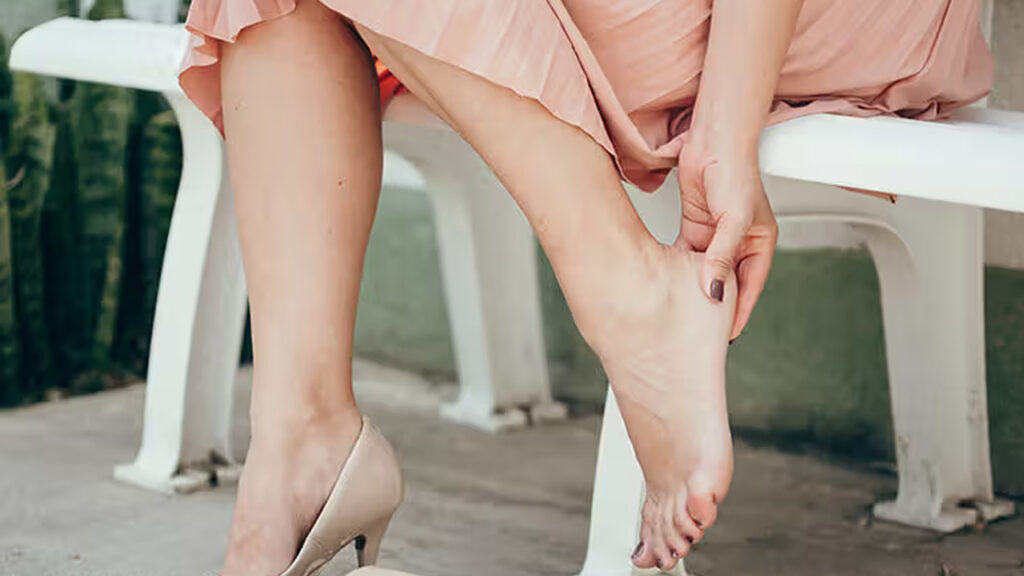 Foot Cracks
