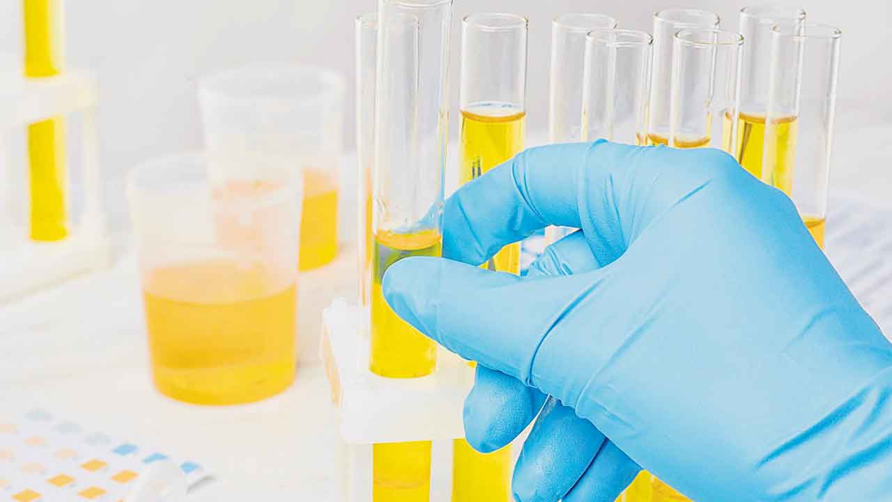 యూరిన్‌ రంగులోఆరోగ్య మర్మాలు