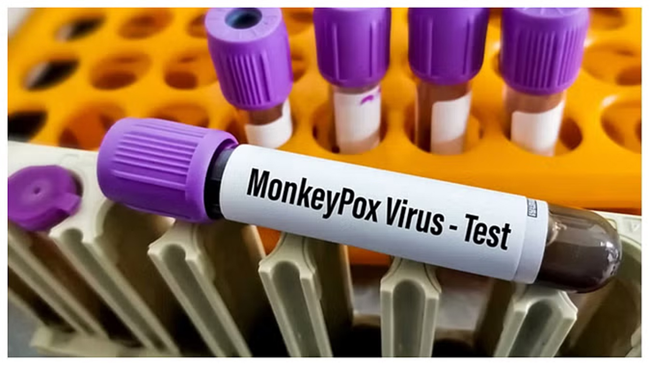 MPox | కేరళలో మరో వ్యక్తికి మంకీపాక్స్‌.. అడ్వైజరీ జారీ చేసిన కేంద్ర ఆరోగ్యశాఖ