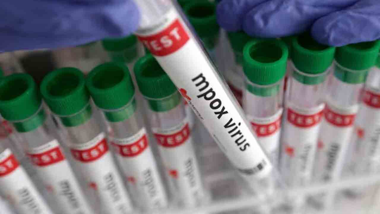 Mpox Case | కేరళ వ్యక్తికి మంకీ పాక్స్.. దేశంలో రెండో కేసు