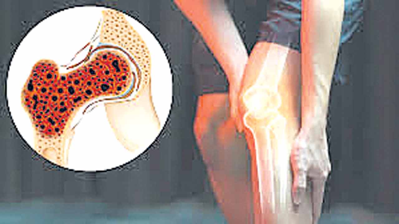 Bone cancer | ఎముకల క్యాన్సర్‌కు గాలియంతో చెక్‌!