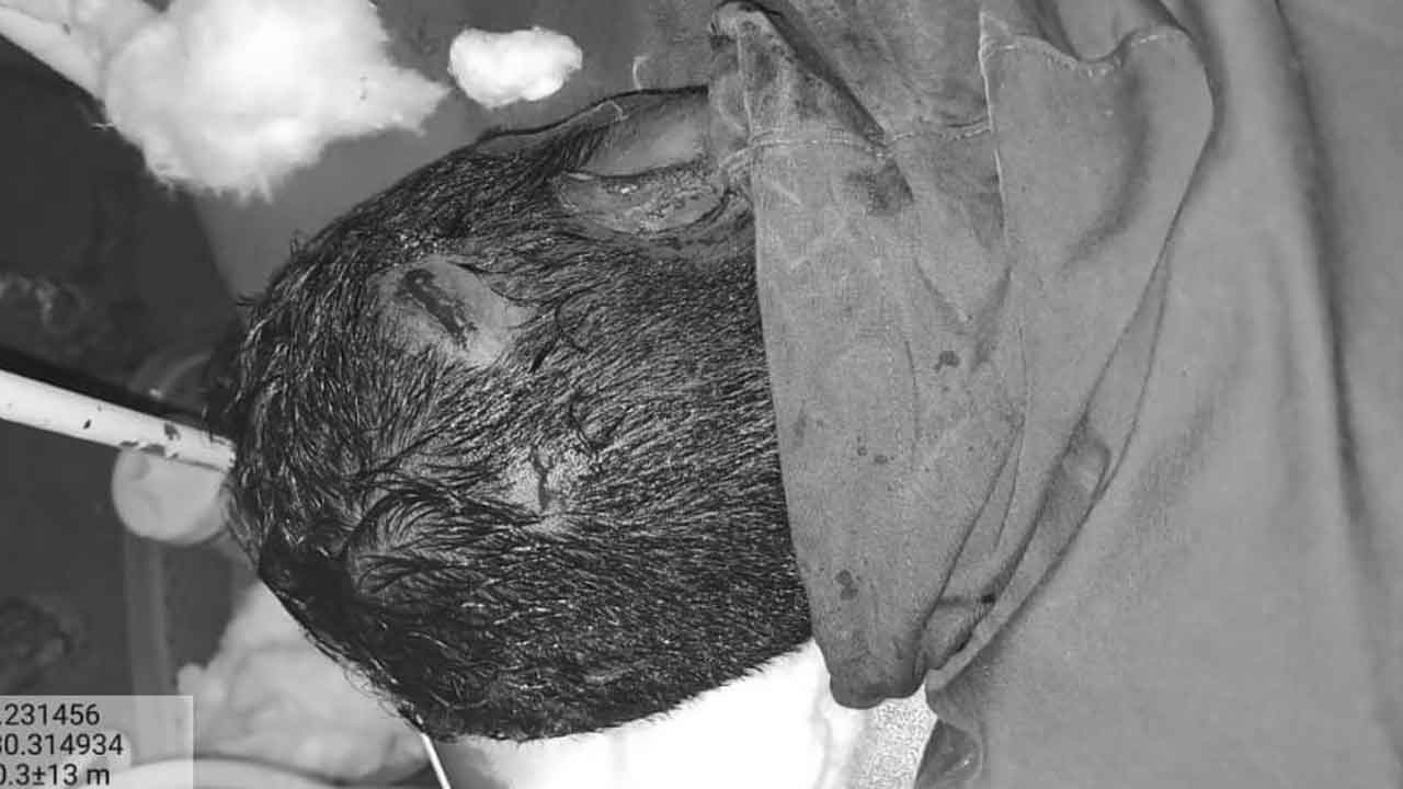 Mulugu | అటవీ శాఖ అధికారులపై ఇనుప రాడ్లతో దాడి, ఇద్దరికి తీవ్ర గాయాలు