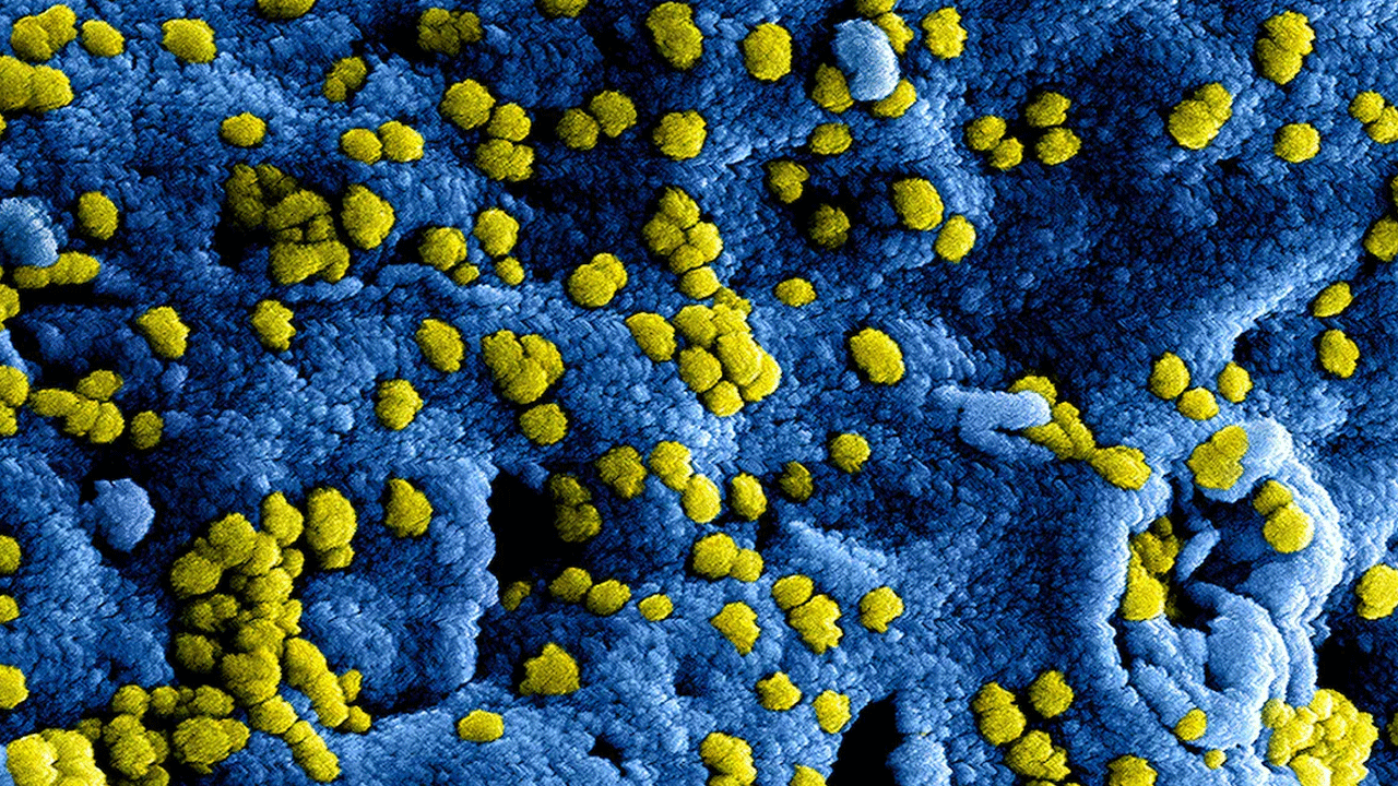 Antibiotic-Resistant Infections: అతిగా యాంటీబ‌యోటిక్‌ల వాడకం.. 2050 నాటికి 4 కోట్ల మంది మ‌ర‌ణించే ఛాన్స్