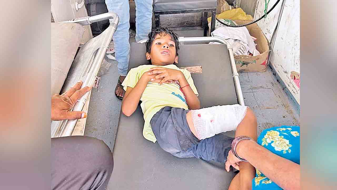 బాలుడిపై వీధి కుక్కదాడి