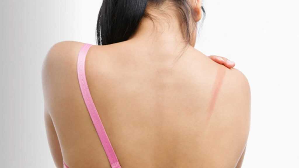 Bra Straps