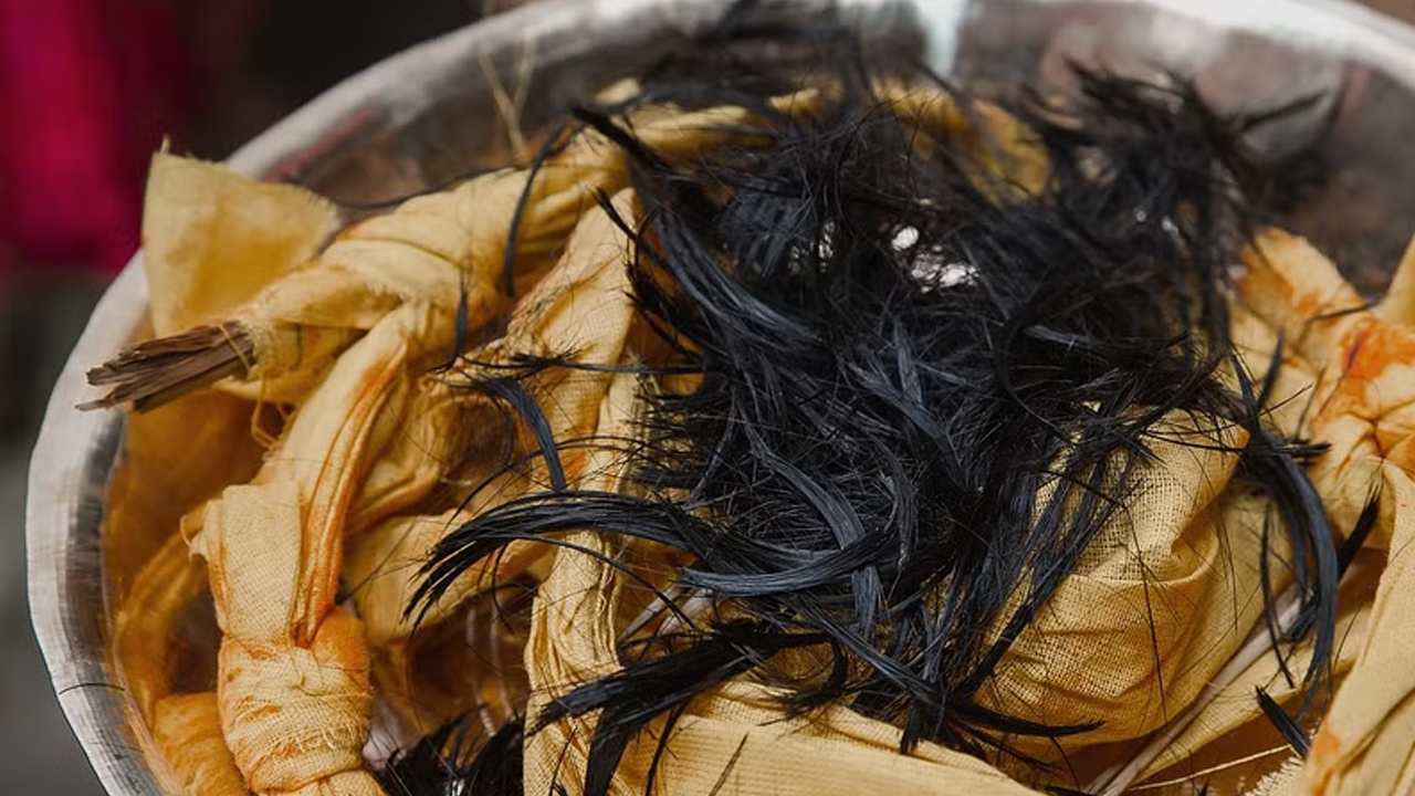 Viral news | మహిళ కడుపులో రెండు కిలోల వెంట్రుకలు.. షాకైన డాక్టర్లు