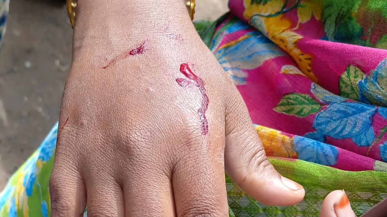 వైద్యం డబ్బులు ఇవ్వలేదని..