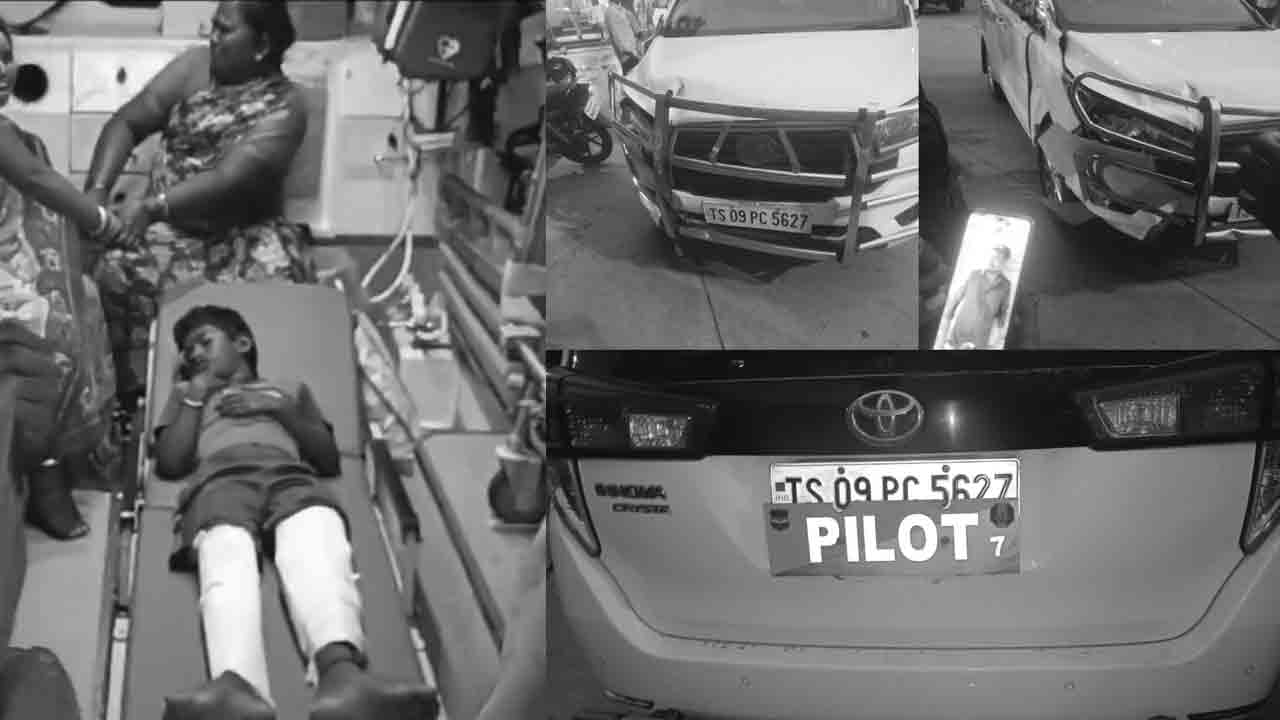 Sridhar Babu Convoy | మంత్రి శ్రీధ‌ర్ బాబు కాన్వాయ్ ఢీకొన‌డంతో.. 8 ఏండ్ల బాలుడికి విరిగిన రెండు కాళ్లు