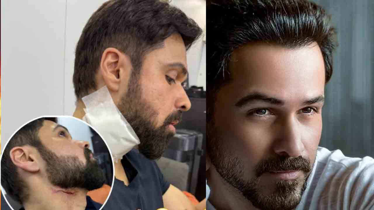 Imran Hashmi | ‘గూఢచారి’ సీక్వెల్ షూటింగ్లో బాలీవుడ్ నటుడికి గాయం