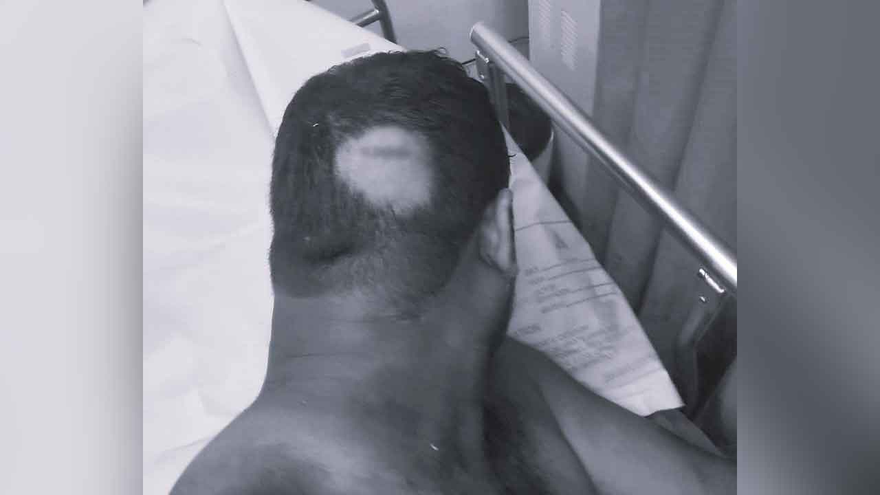 Wife beat husband | వీపు రుద్దమన్నందుకు భర్తను రాడ్తో కొట్టిన భార్య.. పోలీస్ స్టేషన్కు చేరిన పంచాయితీ