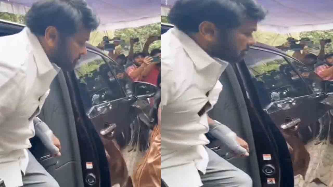 Megastar Chiranjeevi | మెగాస్టార్ చిరంజీవి చేతికి గాయం.. ఫోటోలు వైర‌ల్.!