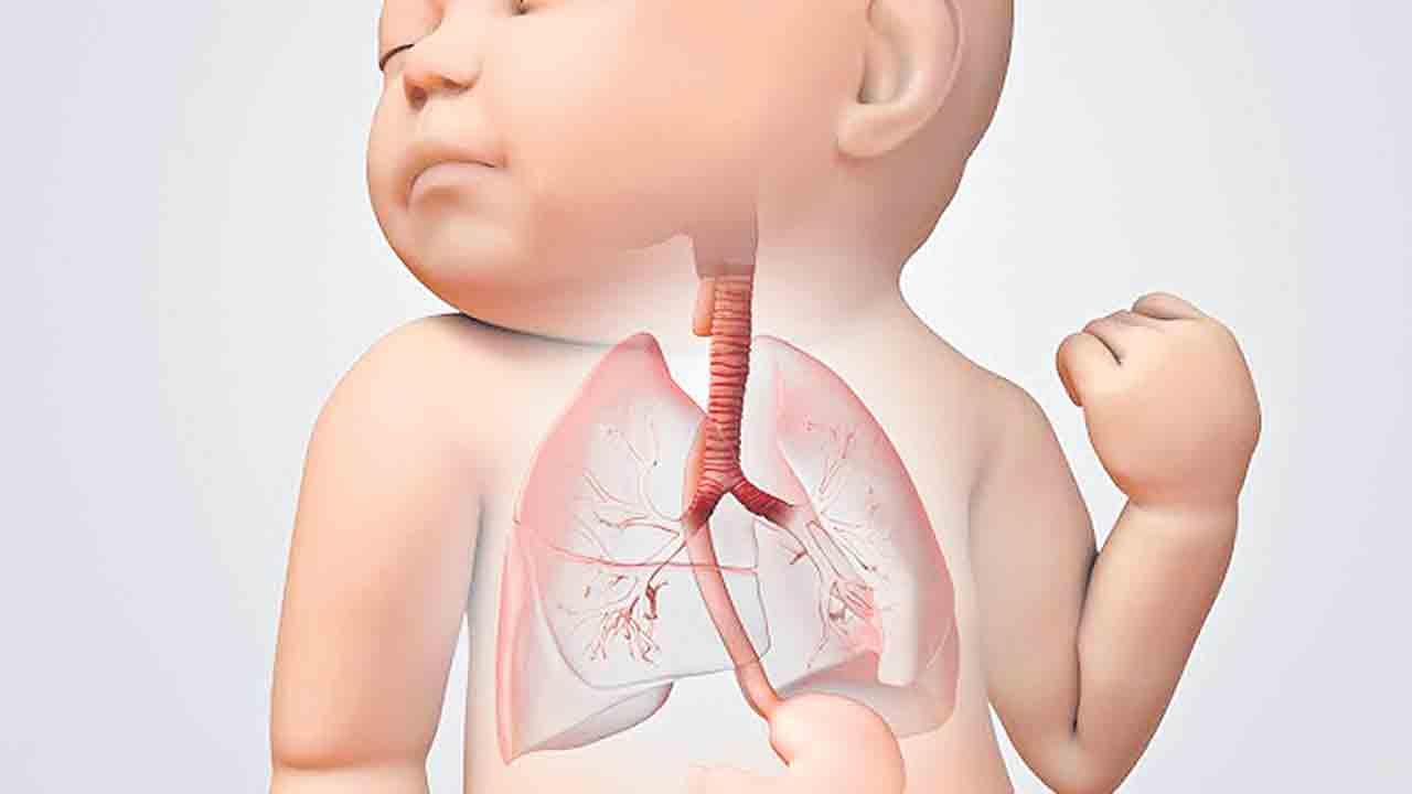 పుట్టుకతోనే అన్న నాళం మూసుకుపోతే..