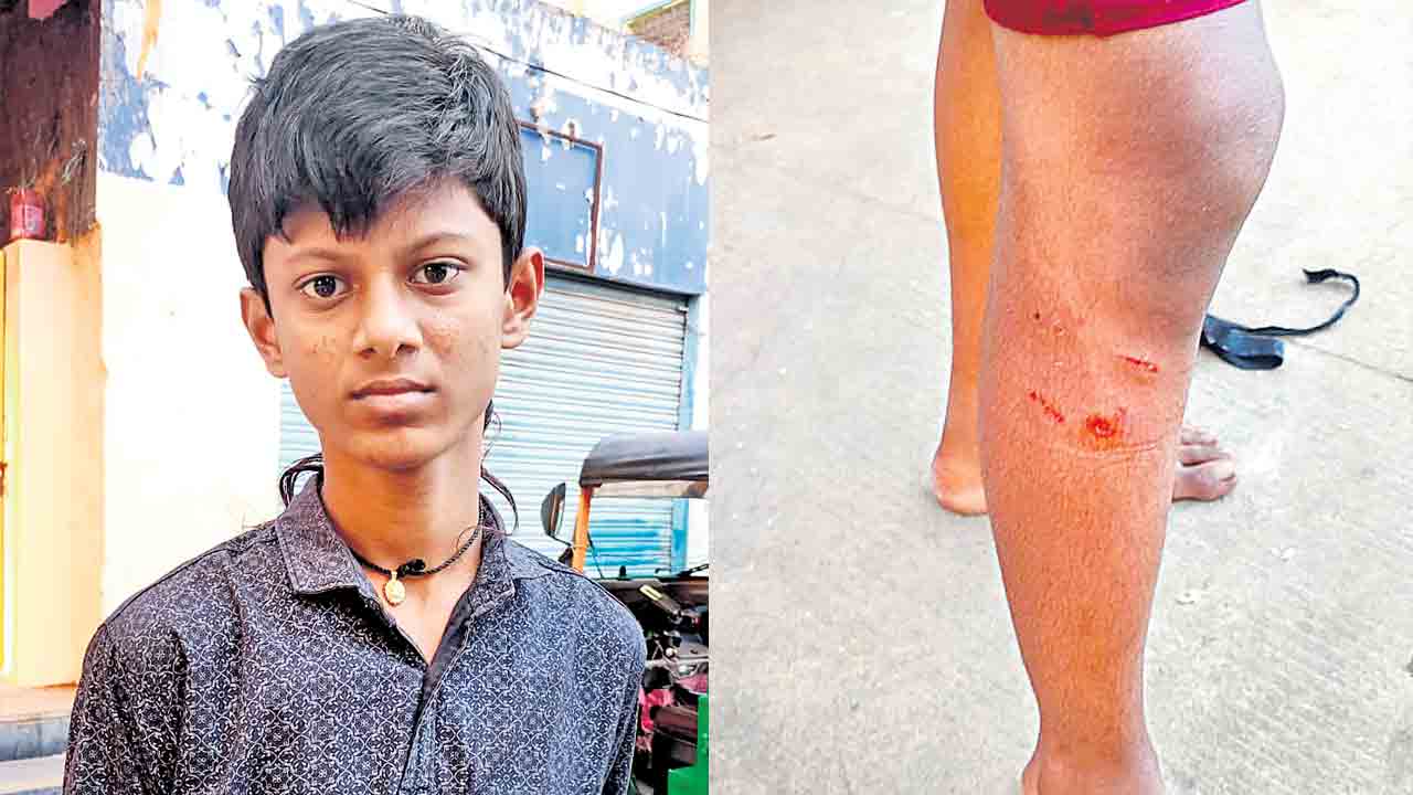 వీధి కుక్క స్వైర విహారం