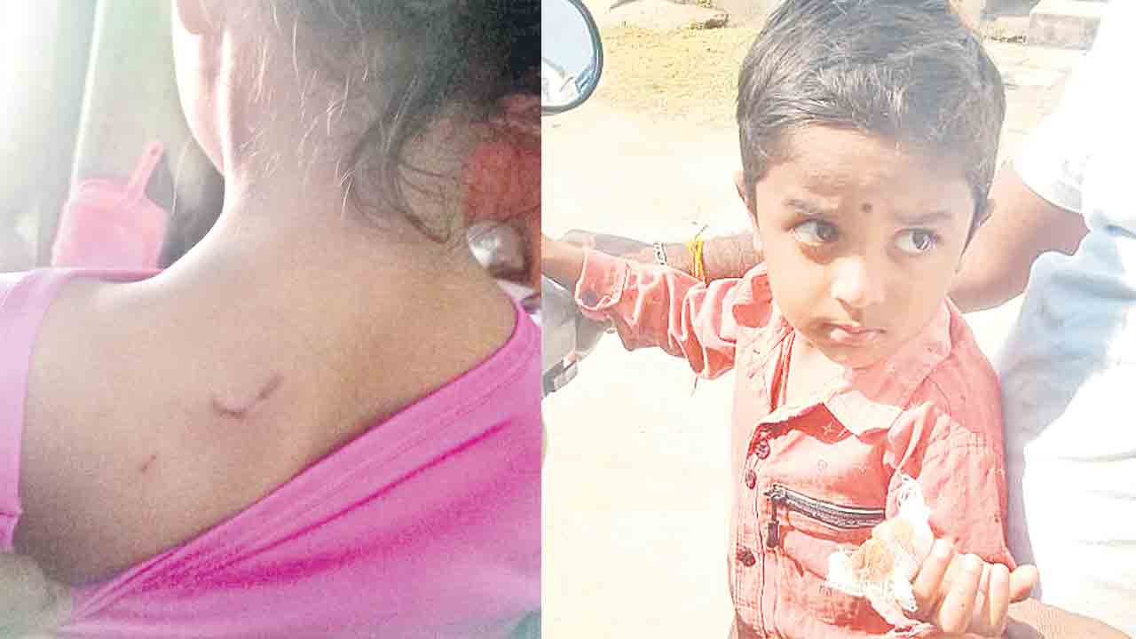 బాల్కొండలో వీధికుక్కల స్వైరవిహారం