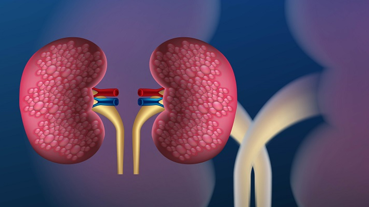 Health Tips | మీకు కిడ్నీ సమస్య ఉందా.. అయితే మీ డైట్‌లో వీటిని కచ్చితంగా చేర్చాల్సిందే..!